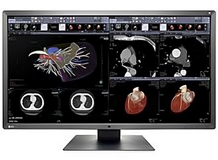 mri diagnostic monitors b7c transformed